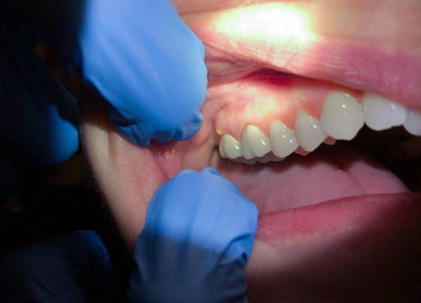 Best Urgent Dental Care for Toothaches in Lake Landor, VA
