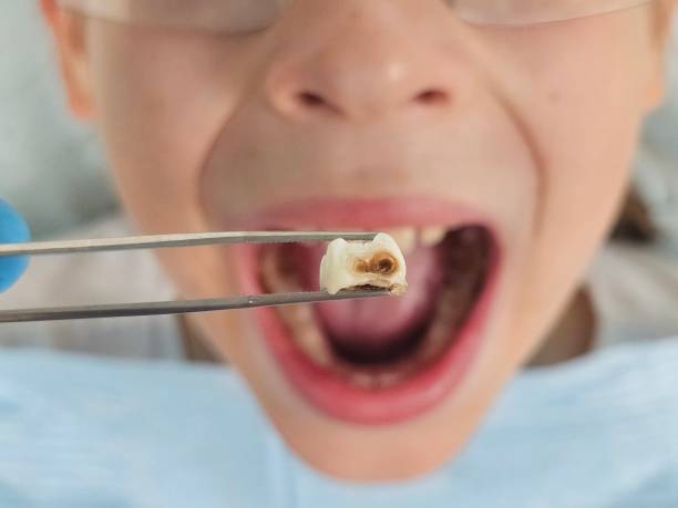 Best 24-Hour Emergency Dental Care in Lake Landor, VA