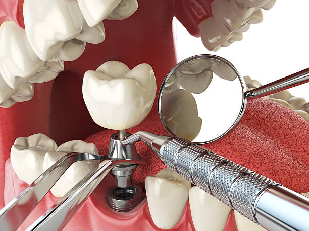 Best Emergency Care for Gum Disease in Lake Landor, VA